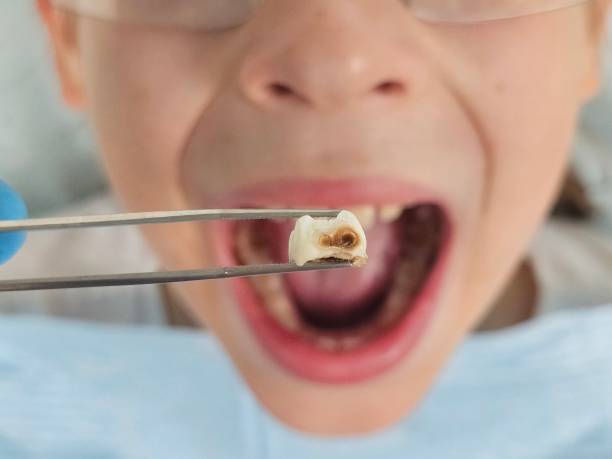 Best Emergency Dental Care for Sports Injuries in Craig, AK